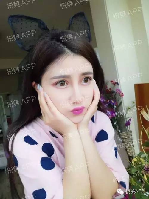 闺蜜说好一起丑,你却偷偷美成狗!|自体脂肪填充