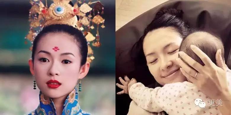 退的发际线,我该拿什么拯救你?|发际线|植发|杨