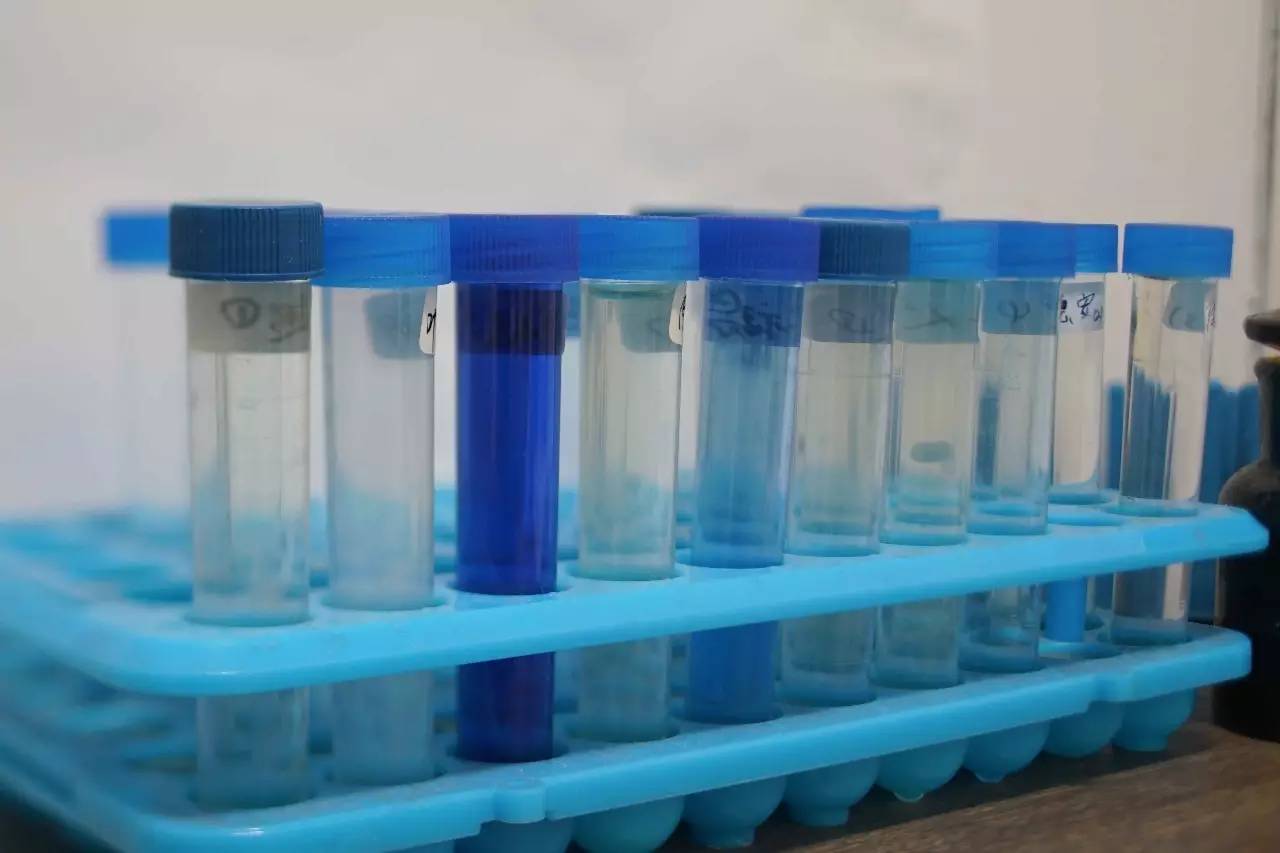 百草枯中毒病人灌流前的尿液 摄影：vict