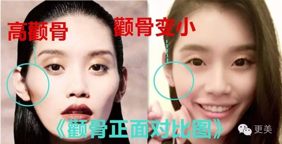 奚梦瑶微调之前的颧骨更突出↓还有奚梦瑶秦舒培杜鹃何穗刘雯是比较