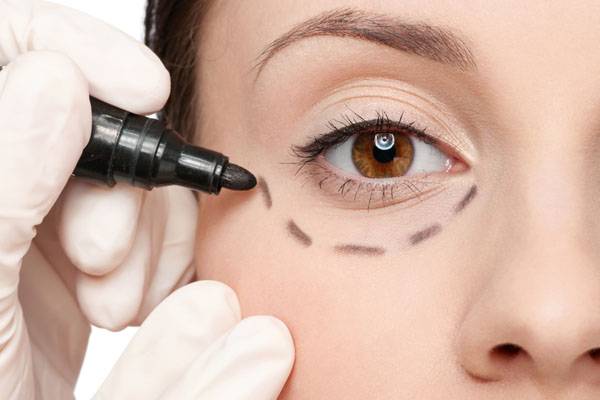 关于眼袋你想知道的都在这篇文章里(三)微整去