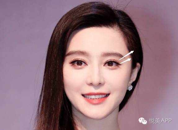 想做成AB、毛晓彤、范冰冰的双眼皮,你必须看