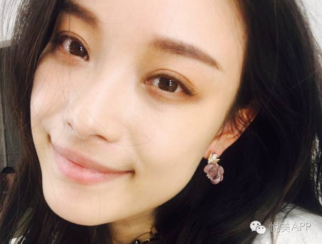 想做成AB、毛晓彤、范冰冰的双眼皮,你必须看