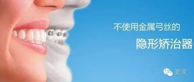 揭内幕 | 隐形牙套凭啥比普通牙套价格高五倍?