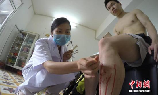 卫计委：国际社会对中医药关注度显著上升