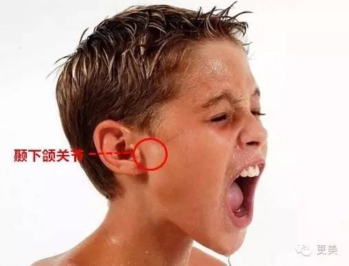 矫正牙齿为什么一定要拔牙?矫正完效果会不会