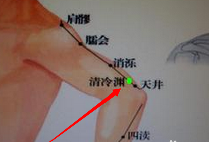 治疗各种头痛的特效穴_脉脉养生_健康