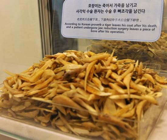 韩国整形博物馆中展览的面部颌角骨