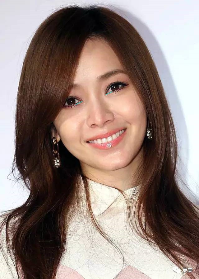 没错,她也有和袁泉一样的问题——斜视.