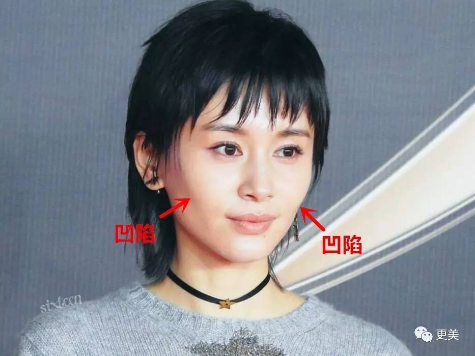 原因1:脸颊凹陷 还是拿王子文举例,因为她暴瘦的太厉害了