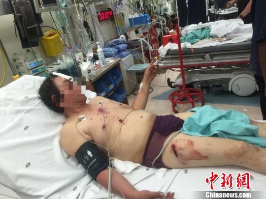 图为受伤男子。　钟欣　摄