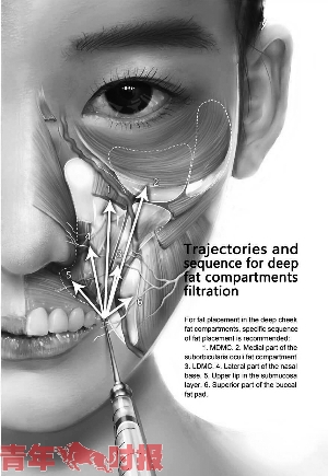 心外科医生的收入_杭州一名外科医生火了！只因画出了这颗超逼真的心(2)