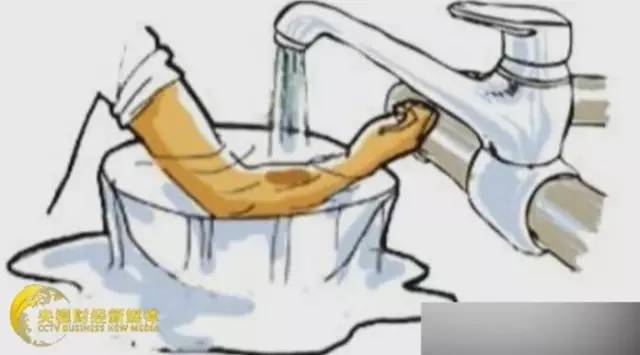 【提醒】酱油?牙膏?烫伤后赶快做这四件事,否