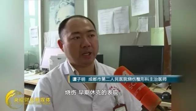 【提醒】酱油?牙膏?烫伤后赶快做这四件事,否