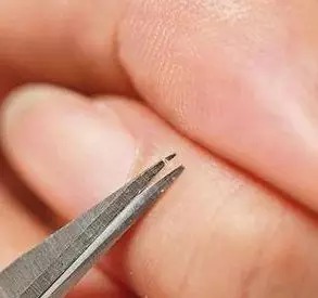 但一个年仅4岁的女孩就因为这个简单的"拔倒刺"动作,面临截肢!