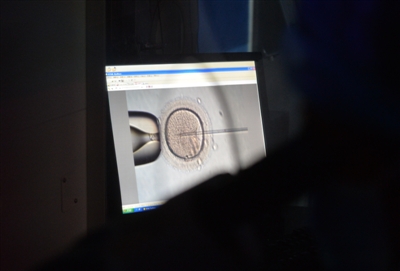 零下196℃冷冻卵子 苏醒 四川首例冻卵试管婴