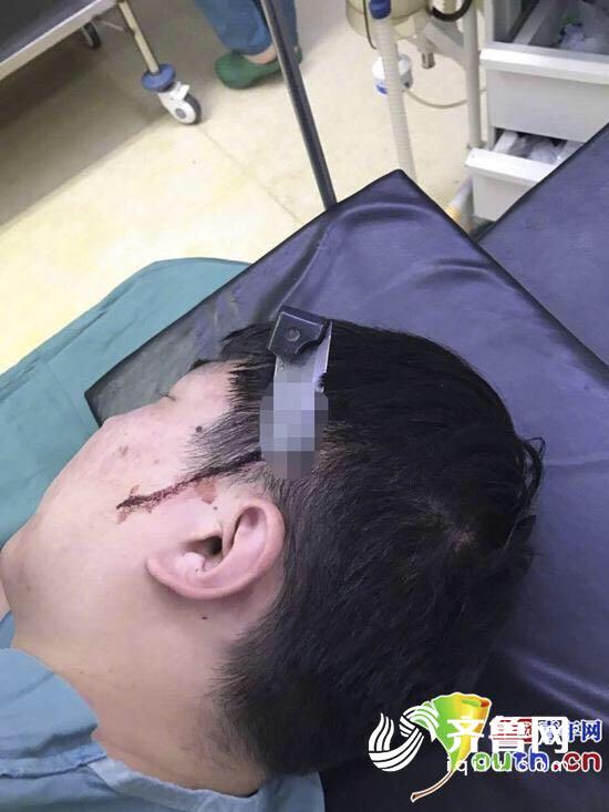 文登医生手术时被捅伤