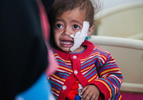 也门冲突升级两周年 联合国吁保障人道准入畅