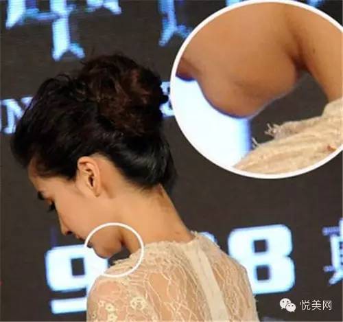 脖子肉多有颈纹 AjS7-fyctevp9241711.jpg