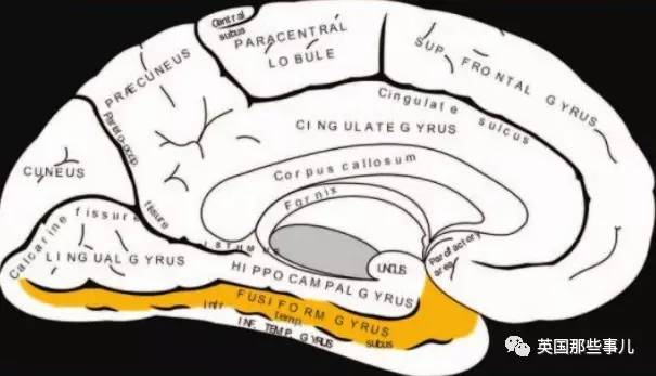 脸盲症是怎么回事 大脑如何影响人脸识别