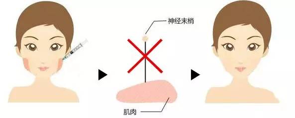 脸型