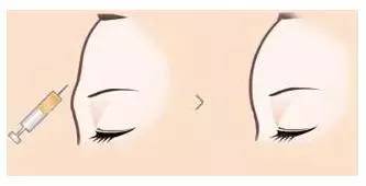 脸型