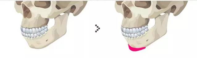 脸型