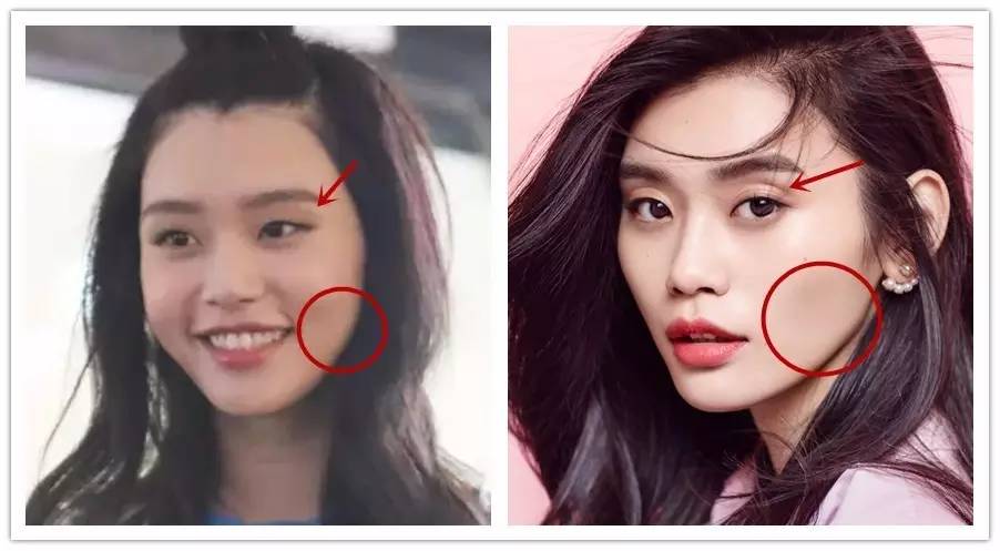 奚梦瑶的长相明明不适合面填啊谁推荐她去整容的