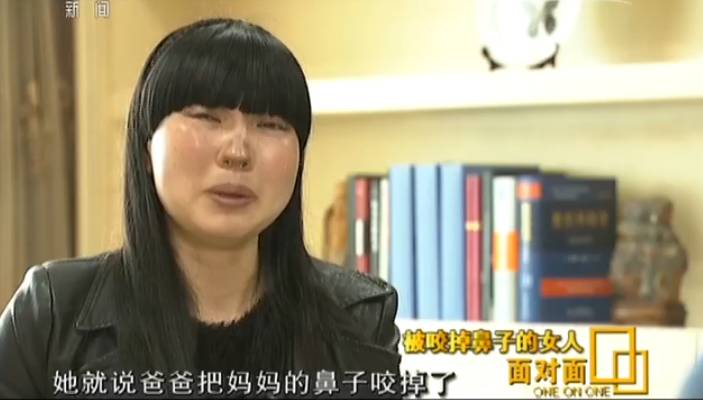 关注| 遭遇家暴被咬掉鼻子 案件昨日宣判!如何拯救家暴受害者?