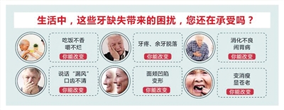 终结缺牙困扰,拯救单颗、多颗、半口牙缺失|威胁|缺牙|缺失_新浪新闻