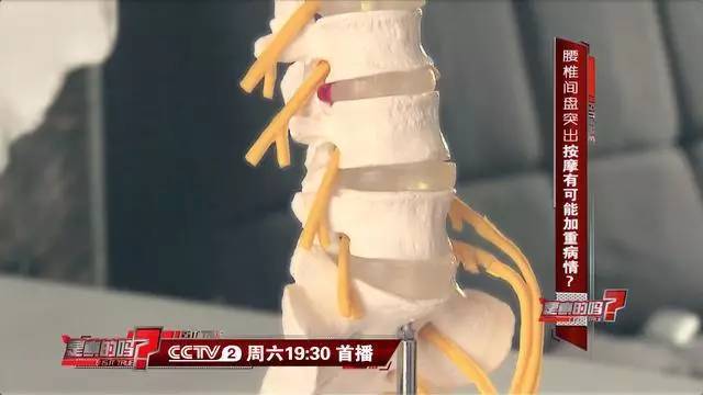 【提醒】腰椎间盘突出千万别乱按摩,严重可致