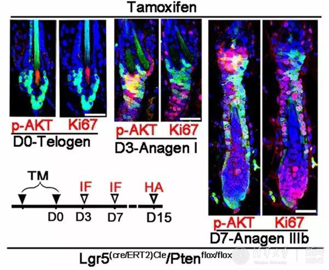 清华深圳研究院吴耀炯教授团队发文揭示皮肤干