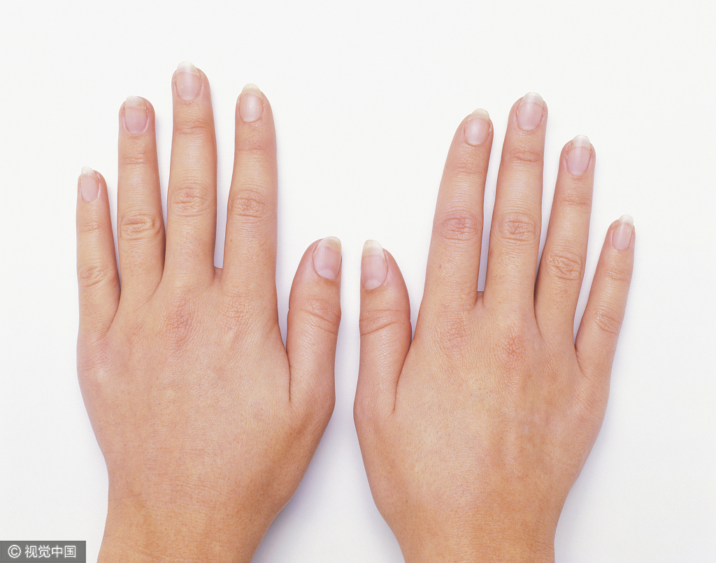 手指甲上没有月牙是缺什么?