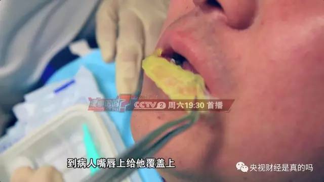 【健康】嘴唇总是起皮，也许不只是干…太可怕