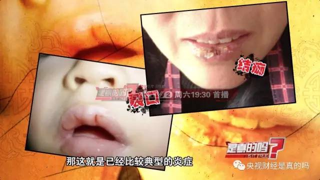 【健康】嘴唇总是起皮，也许不只是干…太可怕