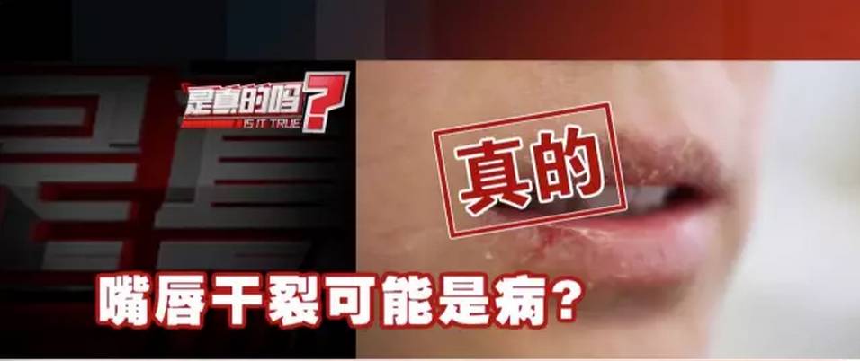 【健康】嘴唇总是起皮，也许不只是干…太可怕