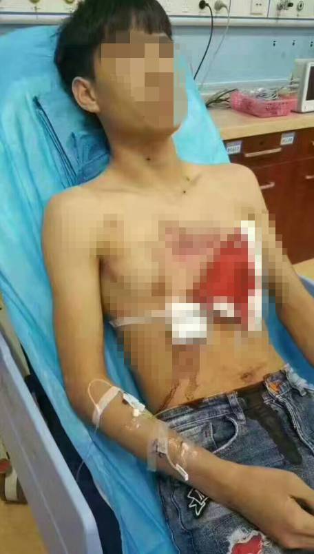 广西数名蒙面男持火药枪进超市扫射 村民胸部中枪