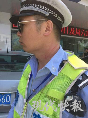 民警脖子被抓出血印。 警方供图