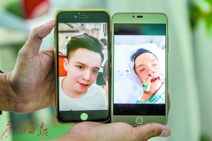 小伙中毒前后对比