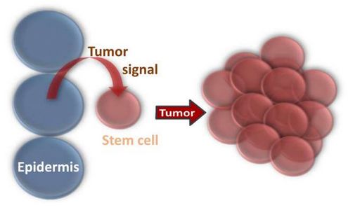 科学家发现导致癌症迅速扩散转移的 根源 !|肿瘤
