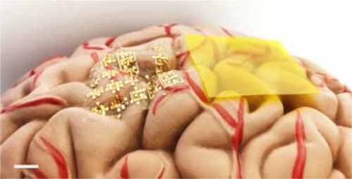 可降解的柔性电子材料,有望减少全球电子垃圾