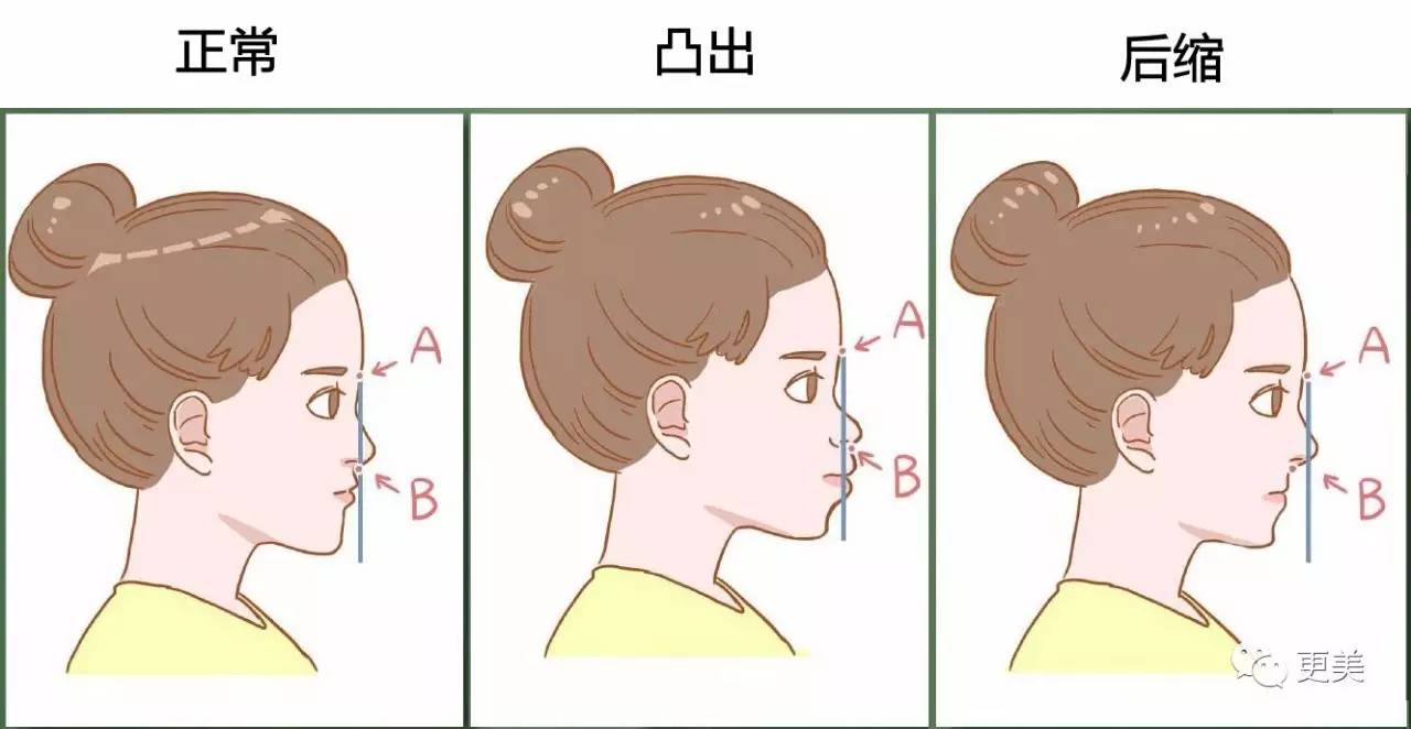 娜扎、王祖贤兔牙变龅牙,都是因为用嘴呼吸、不良吞咽这些坏习惯!|王祖贤|龅牙|门牙_新浪女性_新浪网