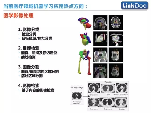 人工智能技术在医学领域的应用与前景