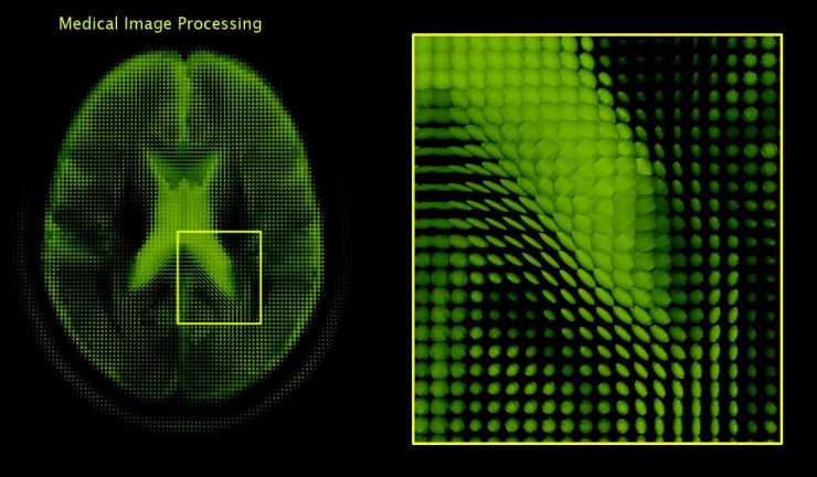 深度学习下的医学图像分析(二)|函数|矩阵|肺癌