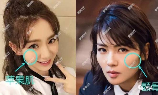 科普贴:秋瓷炫,宋慧乔成冻龄新娘全因苹果肌?