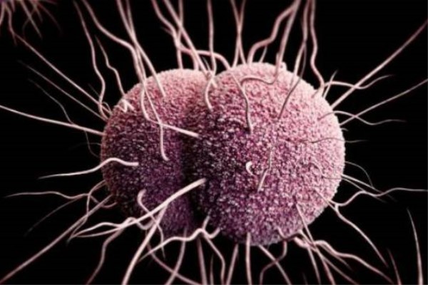 淋病细菌变得越来越聪明,连抗生素也对付不了