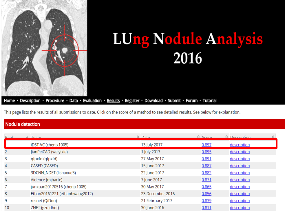 阿里云人工智能ET夺肺结节诊断世界冠军|人工