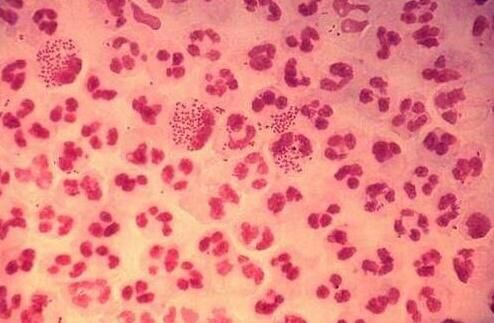 科学家们能否真正攻克淋病?|世界卫生组织|淋病