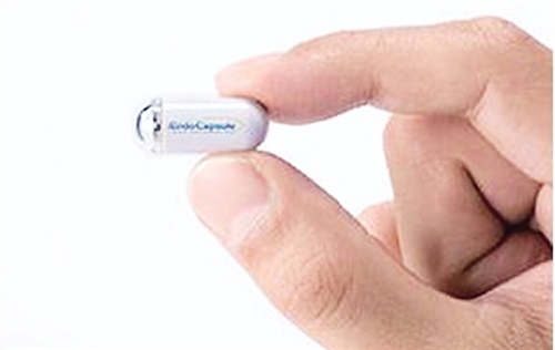 当柔肠遇上“导弹”|导弹|胶囊|内镜_新浪财经_新浪网