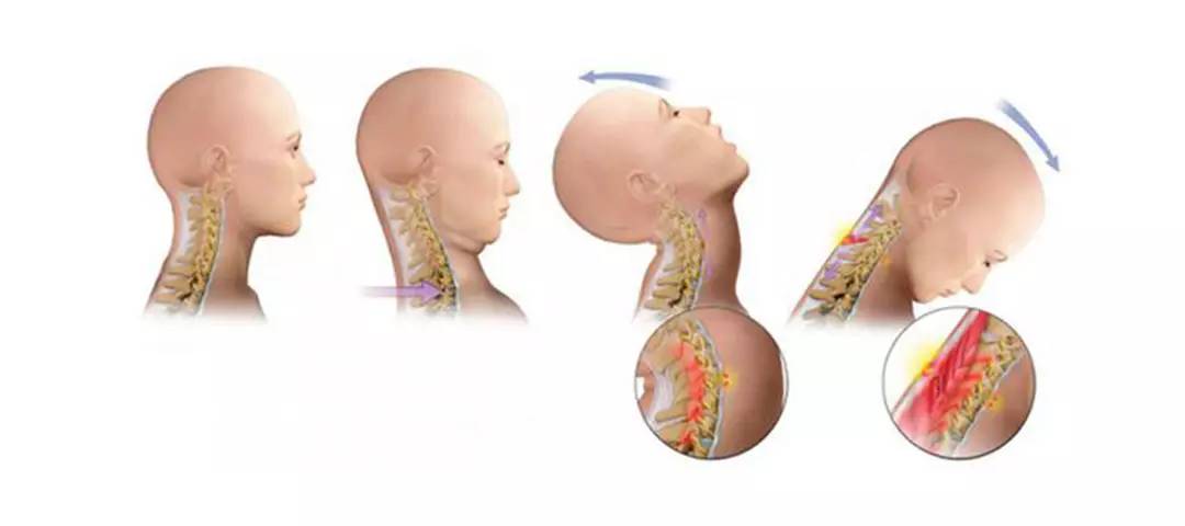 不用多花钱!注意这三点,生存几率大大提升!